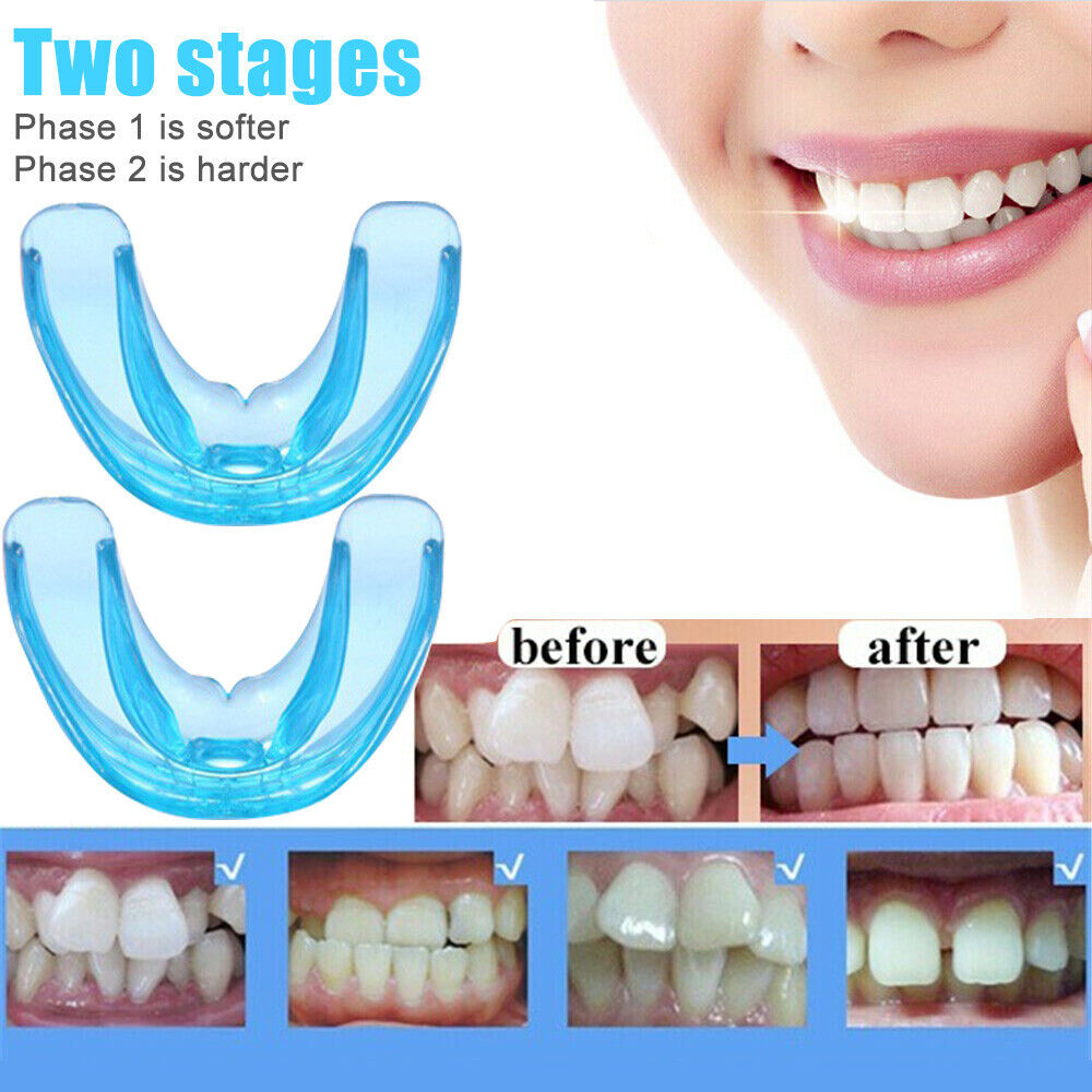 1/2pcs Soft & Hard Dental Orthodontic Teeth Corrector Alignment Tooth Retainer